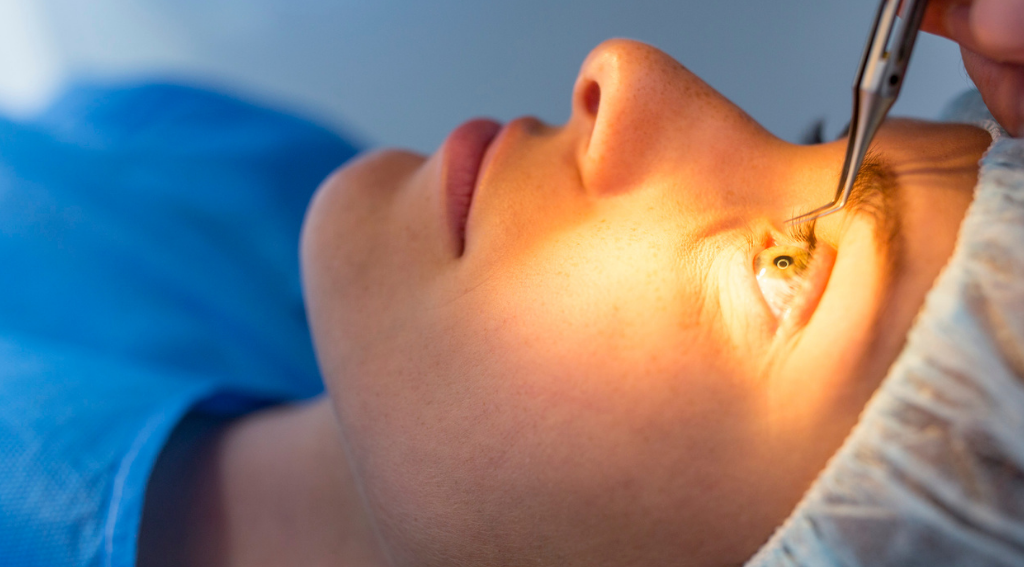 A Typical Surgery Lasik Consultation Covers These Key Steps The current image has no alternative text. The file name is: Lasik-Eye-Surgery-1-1024x640-1.jpeg Replace